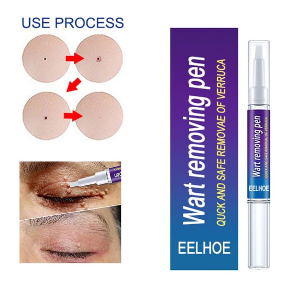 Wart Remover Pen For Skin