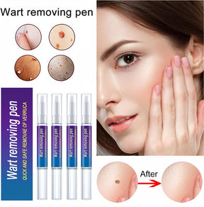 Wart and Mole Removing Pen