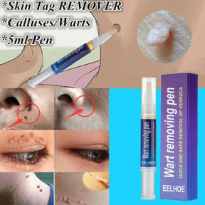 Wart Remover Pen For Skin